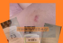 Επίθεση αδέσποτου στο Ωραιόκαστρο Λύση εχθές ζητούν οι πολίτες