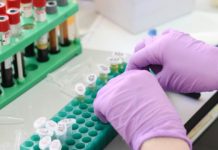 Έρχονται νέοι κόφτες στις διαγνωστικές εξετάσεις των ασφαλισμένων του ΕΟΠΥΥ