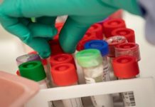 Έξαλλη η επιστημονική κοινότητα: Αφήστε την χλωροκίνη, θα σας σκοτώσει