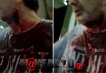 Πυροβόλησαν τον Στέφανο Χίο-Στο νοσοκομείο ο δημοσιογράφος-Οι πρώτες πληροφορίες