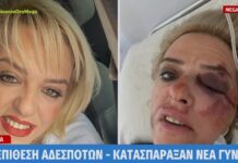 Άγρια επίθεση αδέσποτων σε νεαρή γυναίκα – Τι περιγράφει το θύμα της επίθεσης