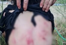 Θεσσαλονίκη: Συγκλονίζει 44χρονη που δέχτηκε επίθεση από σκυλιά