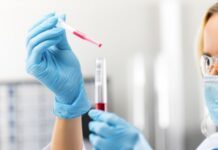 Γρίπη των πτηνών: Επιβεβαιώθηκε κρούσμα στη λίμνη Κερκίνη