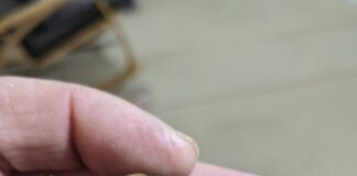 Χελωνάκι με 2 κεφάλια εντοπίστηκε στην Αιτωλοακαρνανία